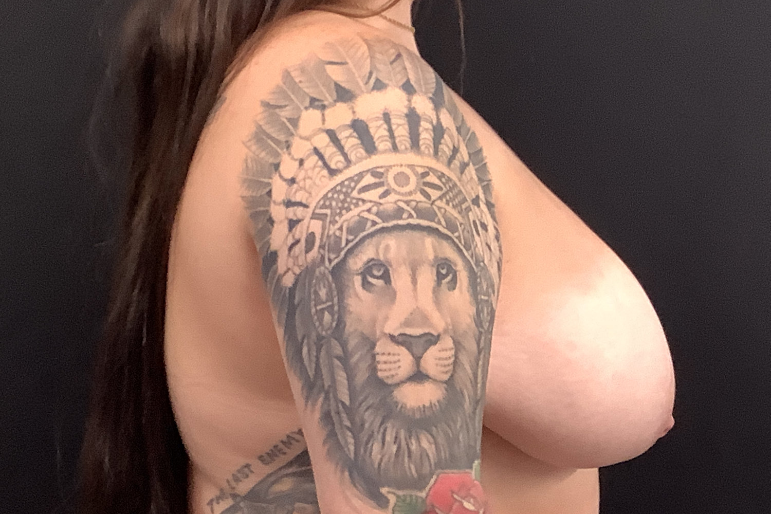 breast reduction