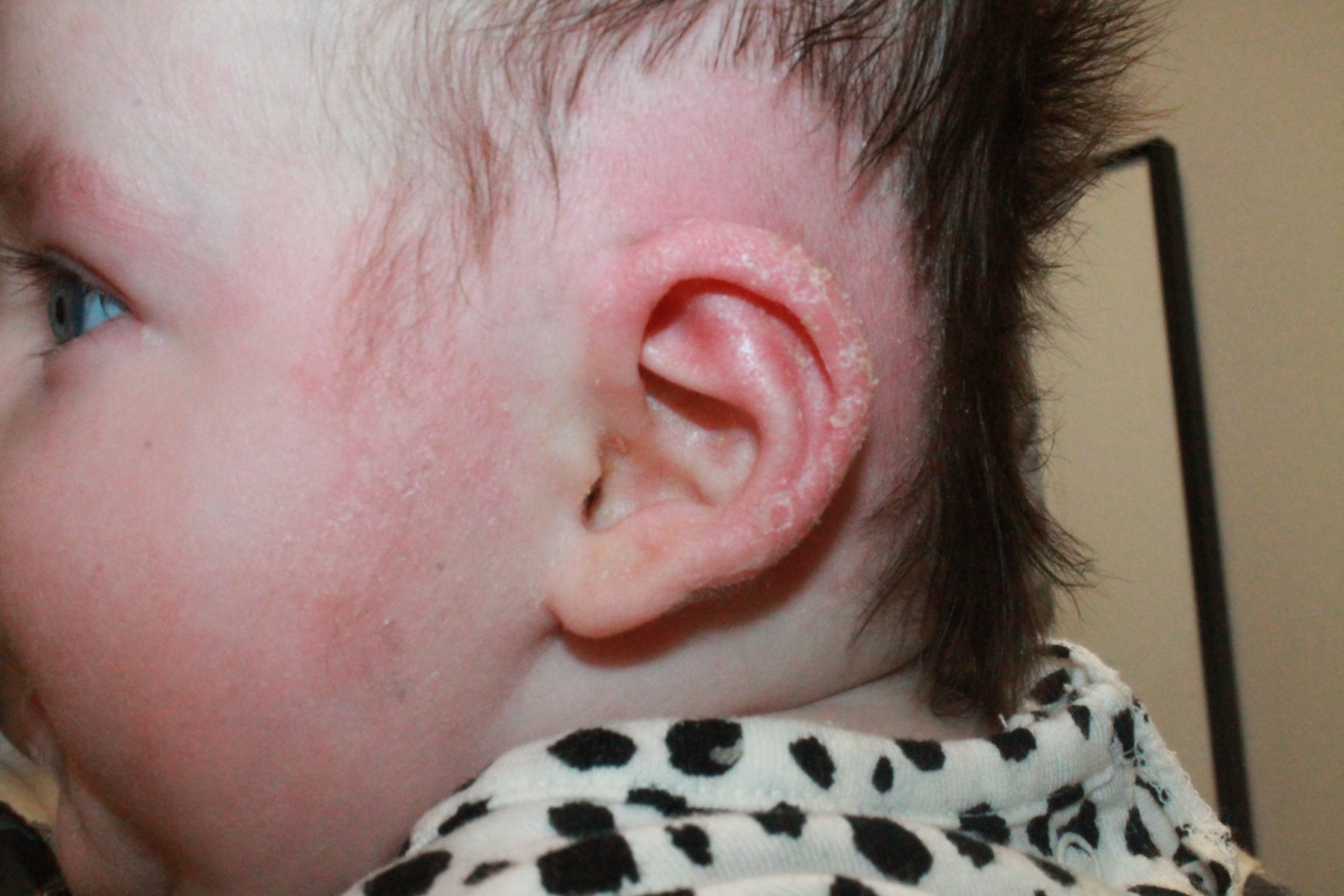 after - 5 week mold process