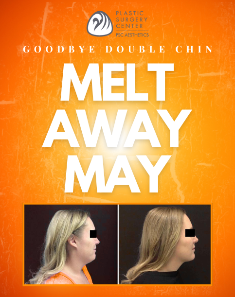melt away